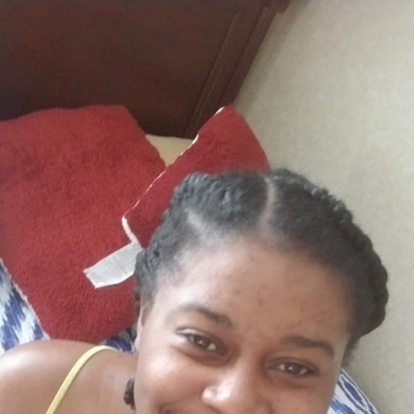 Turmeric and Honey Acne Face Soap - Picture 4 of 5